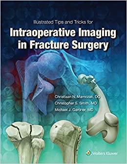 (PDF)Illustrated Tips and Tricks for Intraoperative Imaging in Fracture Surgery First Edition