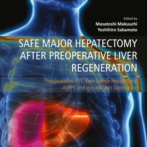 [AME]Safe Major Hepatectomy after Preoperative Liver Regeneration: Preopearative PVE, Two-Satag...
