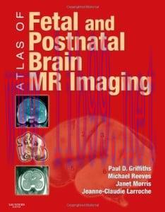[AME]Breast Imaging, An Issue of Radiologic Clinics of North America, 1e (The Clinics: Radiolog...