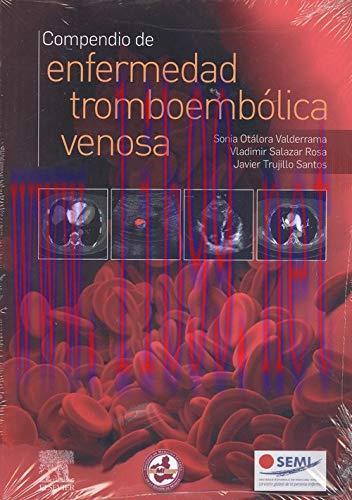 [AME]Compendio de enfermedad tromboembólica venosa (Spanish Edition) (Original PDF)