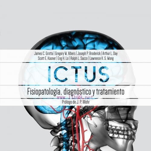 [AME]Ictus: Fisiopatología, diagnóstico y abordaje, 7th edition (True PDF)