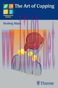 [AME]The Art of Cupping (Complementary Medicine)