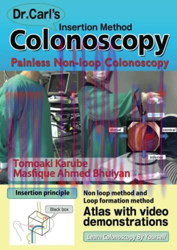 [AME]Dr. Carl's Colonoscopy Insertion Method: Painless Non-loop Colonoscopy (AZW3 + EPUB + Conv...