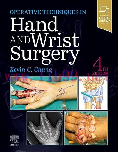 [AME]Operative Techniques: Hand and Wrist Surgery, 4th Edition (Videos, Well-organized)