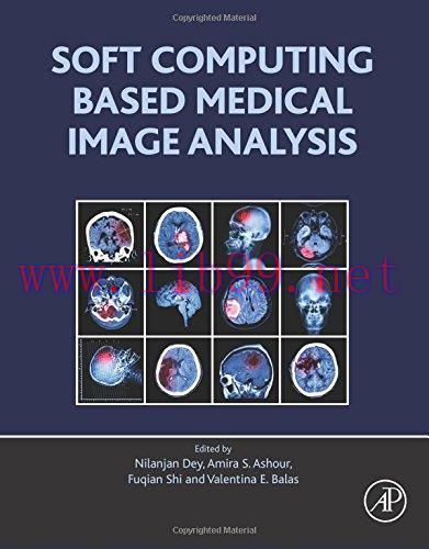 [AME]Soft Computing Based Medical Image Analysis (PDF)