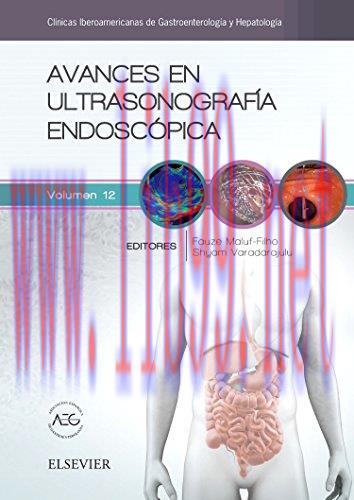 [AME]Avances en ultrasonografía endoscópica (Spanish Edition) (True PDF + ToC + Index)