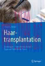 [PDF]Haartransplantation: Grundlagen – Operationstechniken – Tipps und Tricks für die Praxis