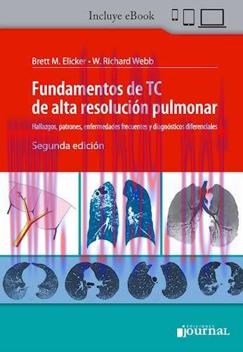 [AME]Fundamentos De Tc De Alta Resolucion Pulmonar Hallazgos, 2ª edición (High Quality Image PD...