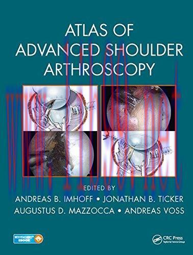 [AME]Atlas of Advanced Shoulder Arthroscopy (PDF)