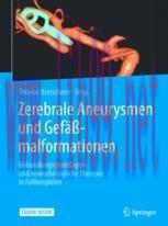 [PDF]Zerebrale Aneurysmen und Gefäßmalformationen: Behandlungsgrundlagen und neurochirurgische ...