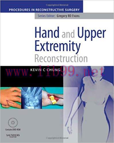 [PDF]Hand and Upper Extremity Reconstruction