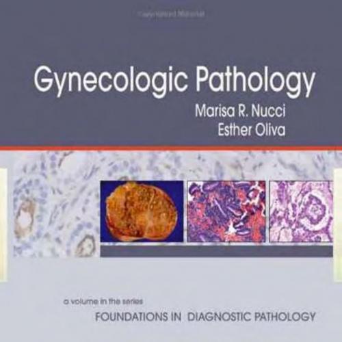 Gynecologic Pathology (Foundations in Diagnostic Pathology Series)