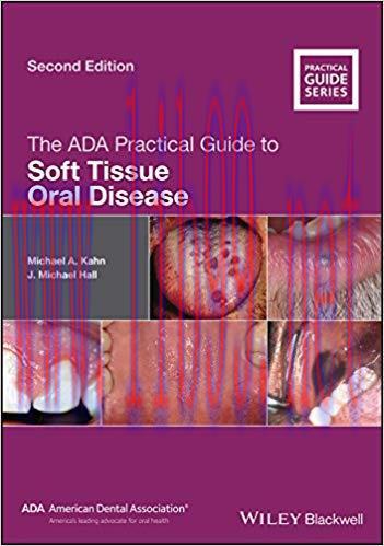 [PDF]The ADA Practical Guide to Soft Tissue Oral Disease