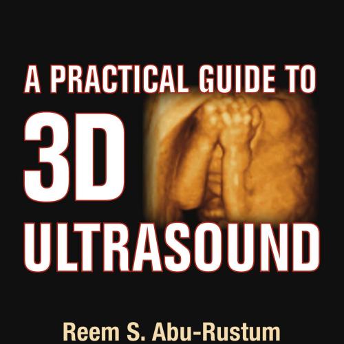 Practical Guide to 3D Ultrasound, A
