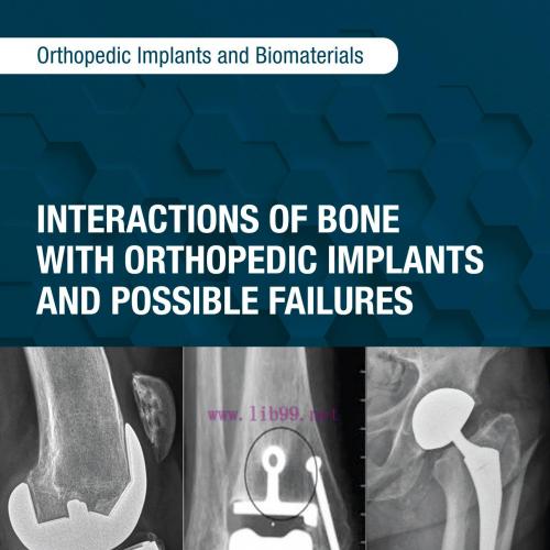 [AME]Interactions of Bone with Orthopedic Implants and Possible Failures (Original PDF)