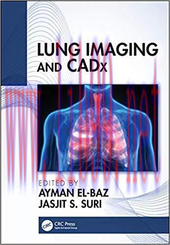 [PDF]Lung Imaging and CADx