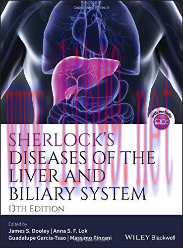 [AME]Sherlock's Diseases of the Liver and Biliary System, 13ed (PDF)