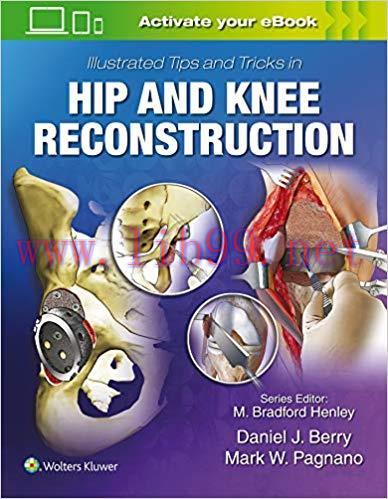[Html]Illustrated Tips and Tricks in Hip and Knee Reconstructive and Replacement Surgery