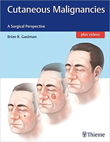 Cutaneous Malignancies - A Surgical Perspective