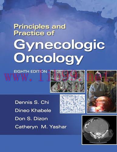 [AME]Principles and Practice of Gynecologic Oncology, 8th Edition (EPUB)