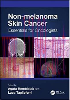 [AME]Non-melanoma Skin Cancer: Essentials for Oncologists (Original PDF)
