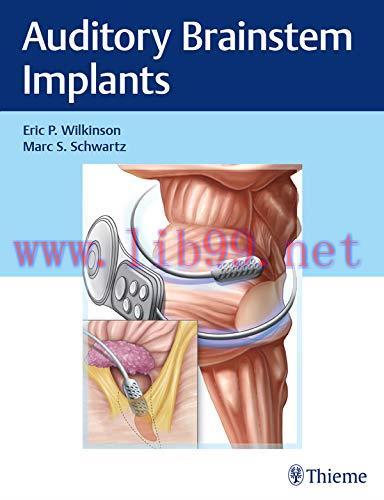 [AME]Auditory Brainstem Implants (Original PDF)