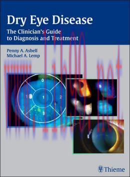 [AME]Dry Eye Disease: The Clinician’s Guide to Diagnosis and Treatment