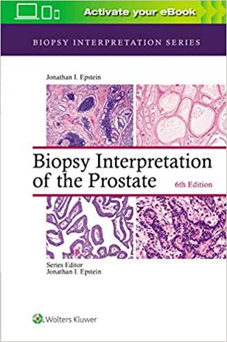 Biopsy Interpretation of the Prostate 6th Edition
