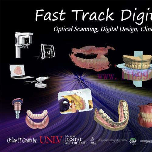 [AME]Step-by-Step Digital Dentures For the Dentist and Technician - Scanners, Software, Lab Tec...