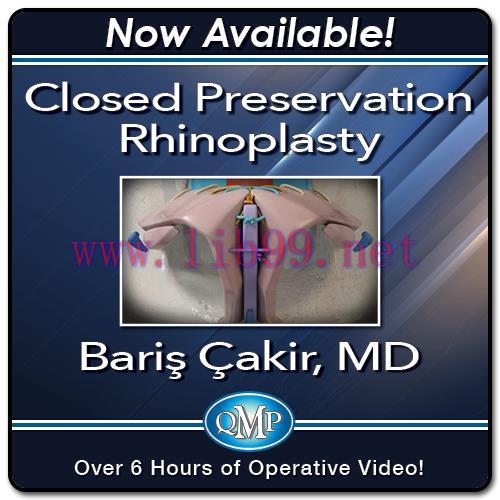 [AME]Closed Preservation Rhinoplasty 2023 (Videos)