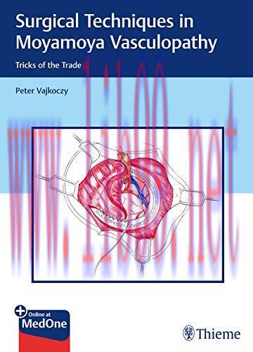 [AME]Surgical Techniques in Moyamoya Vasculopathy: Tricks of the Trade (Original PDF)