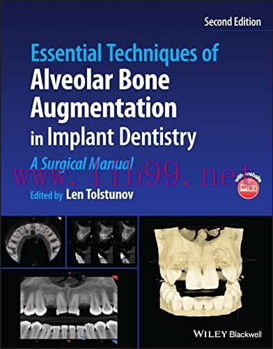 [AME]Essential Techniques of Alveolar Bone Augmentation in Implant Dentistry: A Surgical Manual...