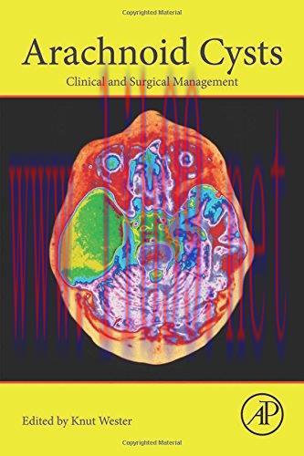 [AME]Arachnoid Cysts: Clinical and Surgical Management (PDF)