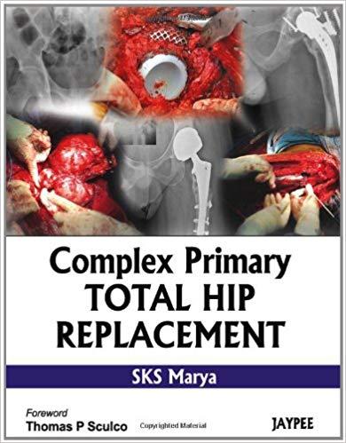 Complex Primary Total Hip Replacement