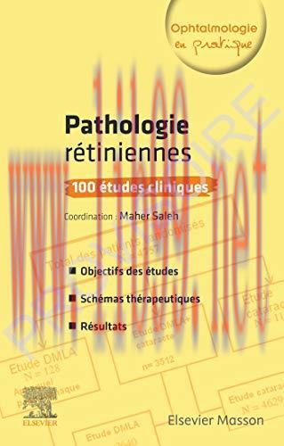[AME]Pathologies rétiniennes : 100 études cliniques: 100 Etudes Cliniques (Ophtalmologie Pratiq...