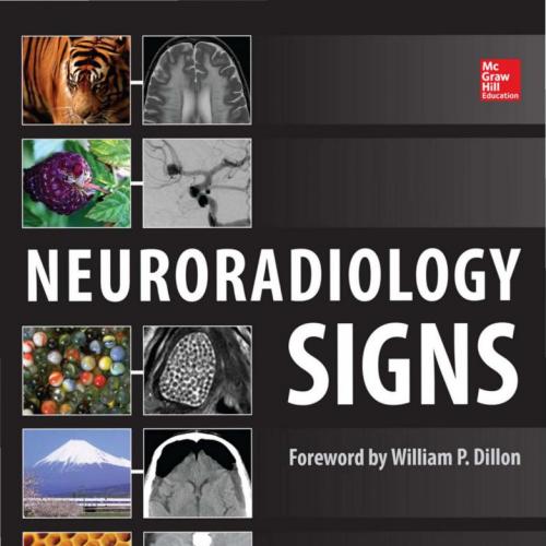 Neuroradiology Signs