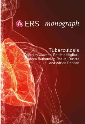 ERS Monograph 82 Tuberculosis