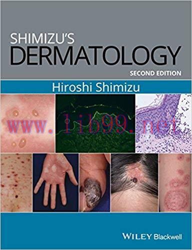 [PDF]Shimizu’s Dermatology, 2nd Edition