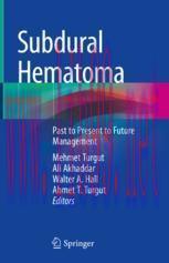 [PDF]Subdural Hematoma: Past to Present to Future Management