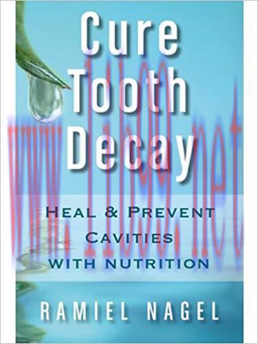 (PDF)Cure Tooth Decay: Heal And Prevent Cavities With Nutrition – Limit And Avoid Dental Surger...