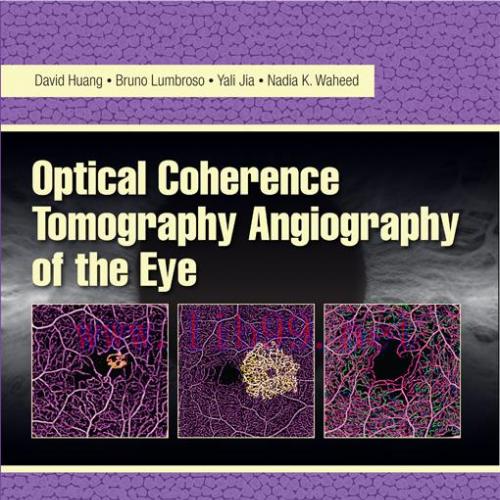 [AME]Optical Coherence Tomography Angiography of the Eye (EPUB)