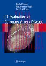 [PDF]CT Evaluation of Coronary Artery Disease