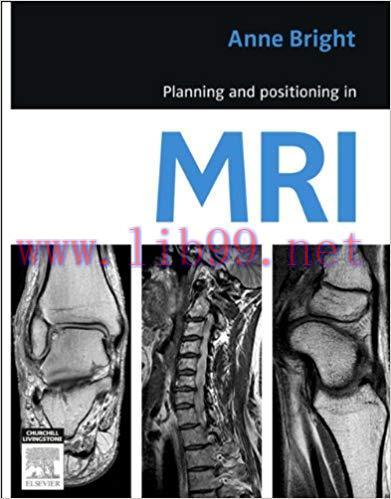 (PDF)Planning and Positioning in MRI – E-Book 1st Edition