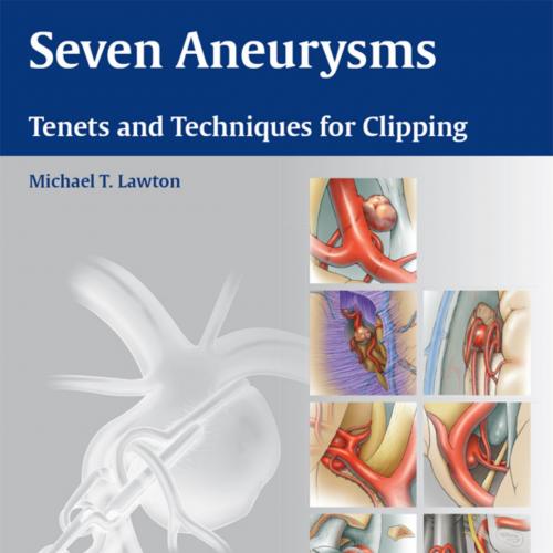 Thieme_ Seven Aneurysms Tenets and Techniques for Clipping