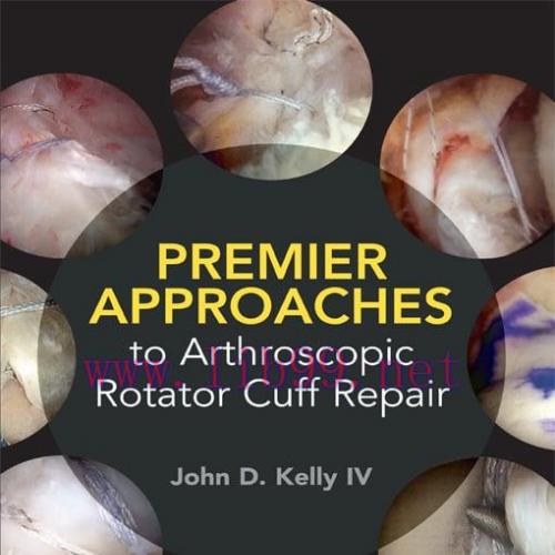 [AME]Premier Approaches to Arthroscopic Rotator Cuff Repair (EPUB)