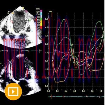 [AME]Echocardiography – A Comprehensive Review 2022 (CME VIDEOS)
