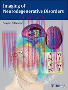 [AME]Imaging of Neurodegenerative Disorders