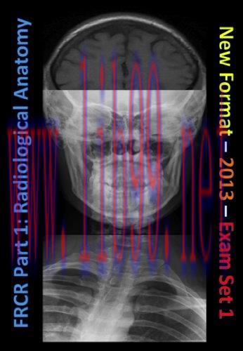 [AME]FRCR Part 1. Radiological Anatomy - New for 2013 - Set 1 (EPUB)