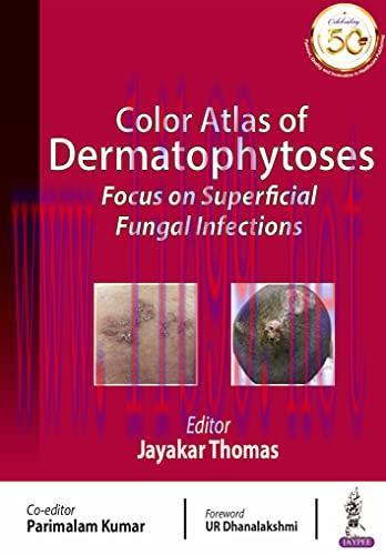 [PDF]Color Atlas of Dermatophytoses Focus on Superficial Fungal Infections