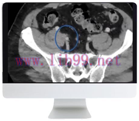 [AME]ARRS Venous Disease: Exploration of Advances, Challenges, and Future Directions 2021 (CME ...